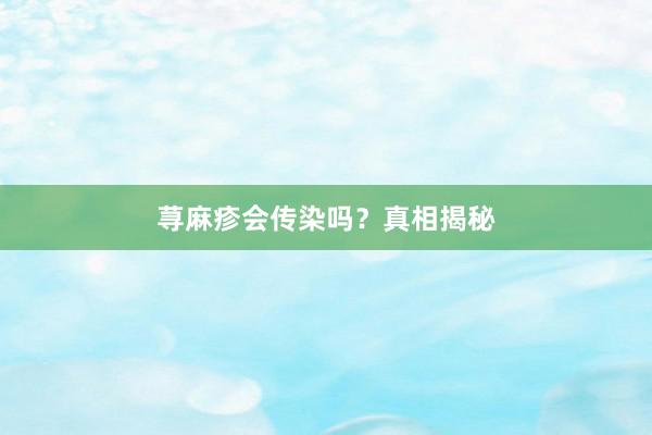 荨麻疹会传染吗？真相揭秘